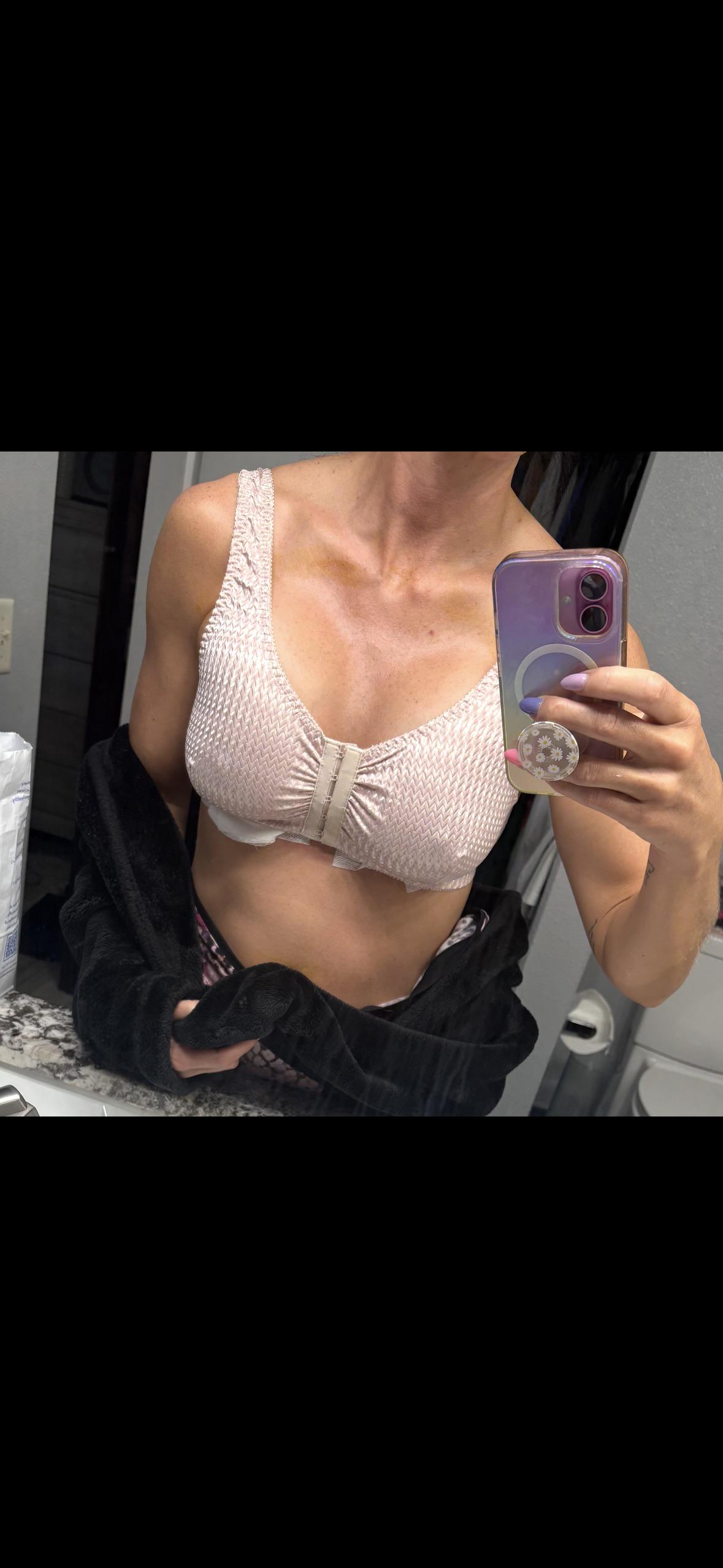 Feeling naughty after my Boobjob